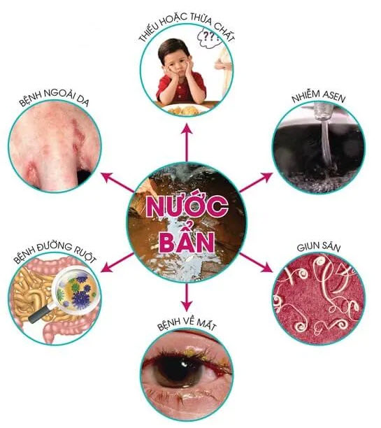 Chuyên Xử Lý Nước Giếng Khoan Tại Vinh Nghệ An Uy Tín & Nhanh Chóng 6
