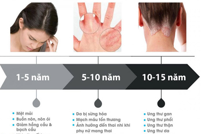 Chuyên Xử Lý Nước Giếng Khoan Tại Vinh Nghệ An Uy Tín & Nhanh Chóng 5